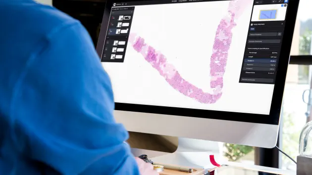 微软宣布与 Paige 合作建立世界最大的基于图像的 AI 模型，旨在识别检测癌症